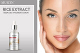 MUICIN - New Rice Extract Mit Hyaluron Serum Buy Online @ Best Price in Pakistan