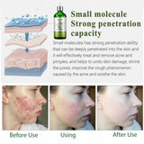 MUICIN - Tea tree Anti Aging Mit Hyaluronic Face Serum  Online @ Best Price in Pakistan