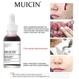 MUICIN - Peeling Solution Serum-RED Online @ Best Price in Pakistan