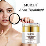 MUICIN - Acne treatment Pimple defence acne scar cream - 50g  Online @ Best Price in Pakistan